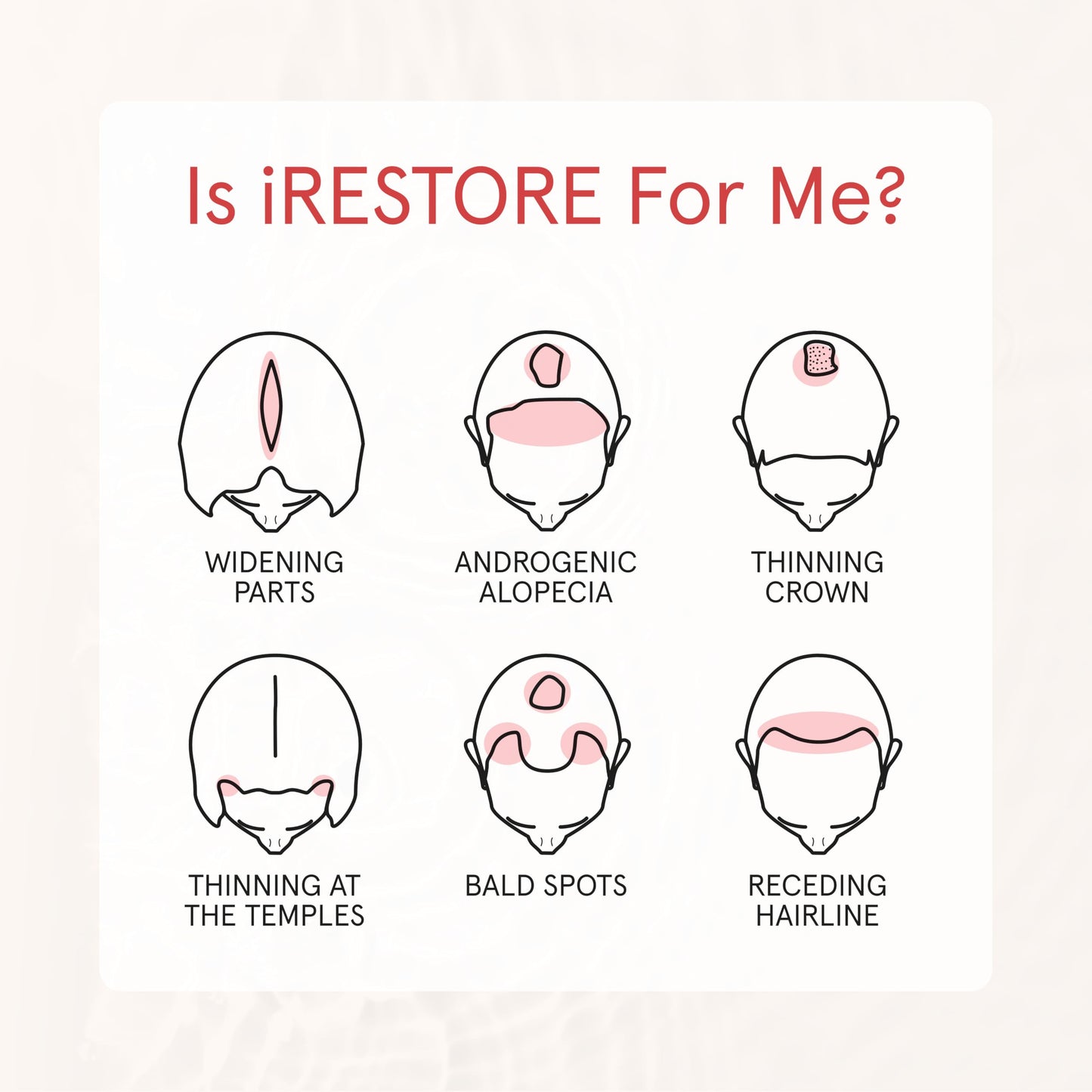 iRESTORE Biotin Hair Conditioner for Damaged Dry Hair - Good for Fine Hair Growth, Volumizing Thickening Conditioner with Ginseng & Argan Oil to Moisturize, Pair With Hair Loss Shampoo