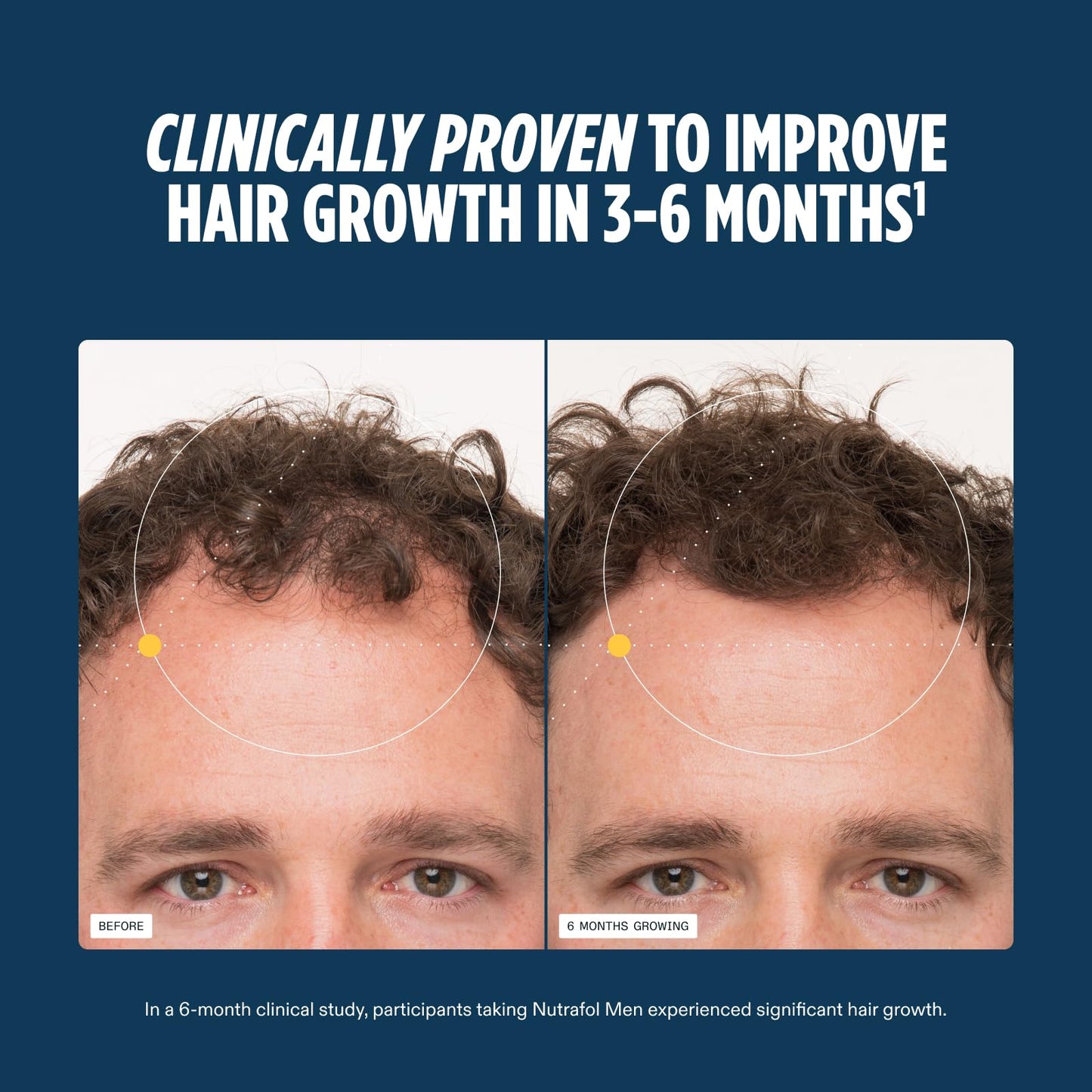 Nutrafol Men's Hair Growth Supplements, Clinically Tested for Visibly Thicker Hair and Scalp Coverage, Dermatologist Recommended - 2 Month Supply, Pack of 2