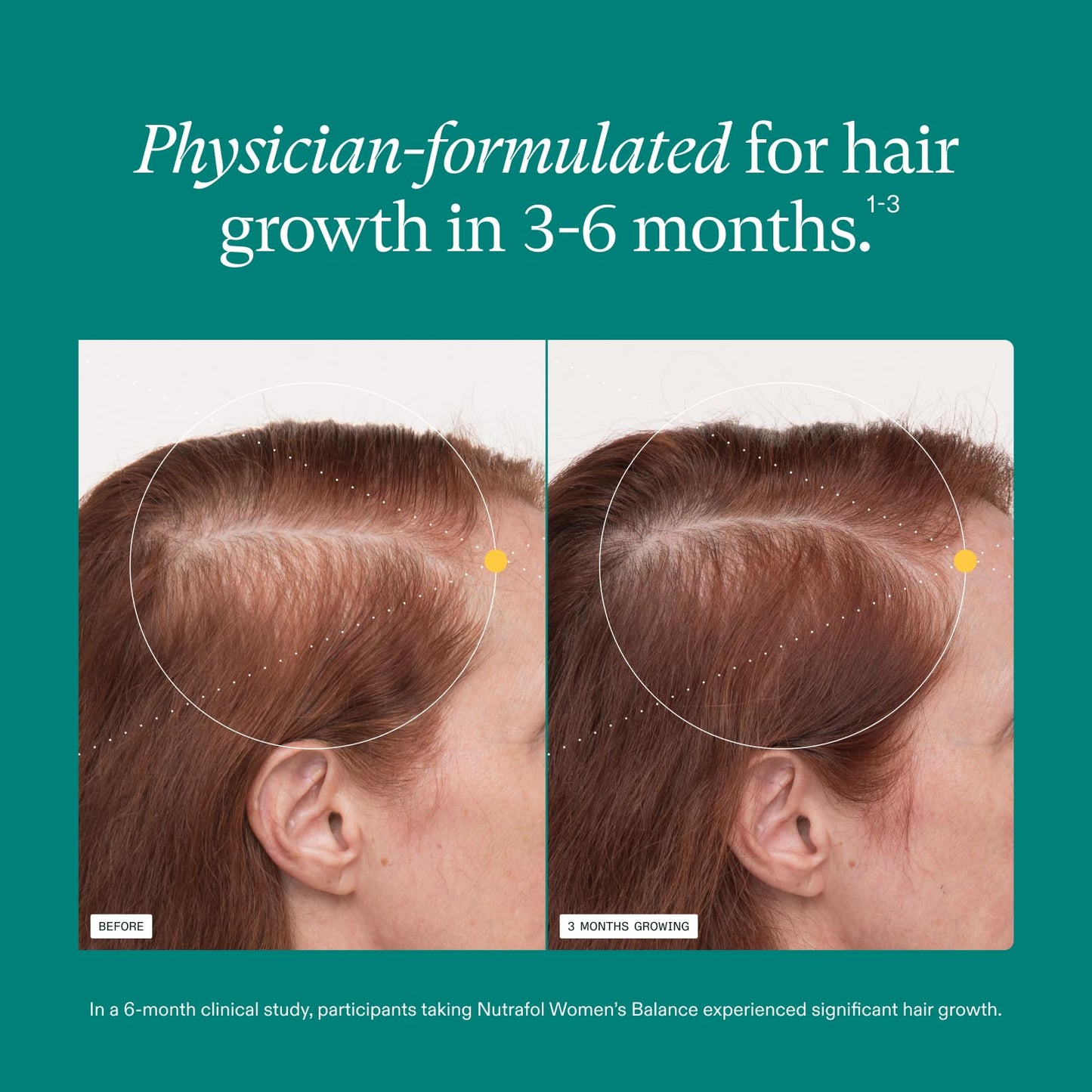 Nutrafol Women's Balance Hair Growth Supplements, Ages 45 and Up, Clinically Tested for Visibly Thicker Hair and Scalp Coverage, Dermatologist Recommended - 1 Month Supply