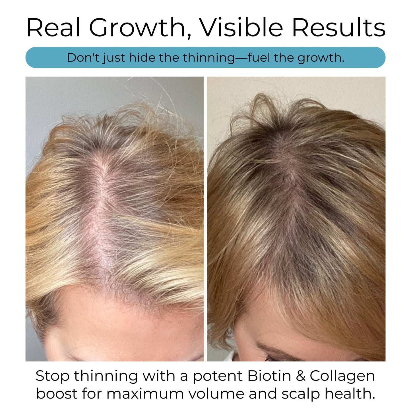 Hush & Hush – Biotin and Collagen Hair Growth Supplements – Hair Vitamins for Women with Ashwagandha – Supports Regrowth, Thicker Hair & Volume – Reduces Hair Loss & Thinning – 120 Capsules
