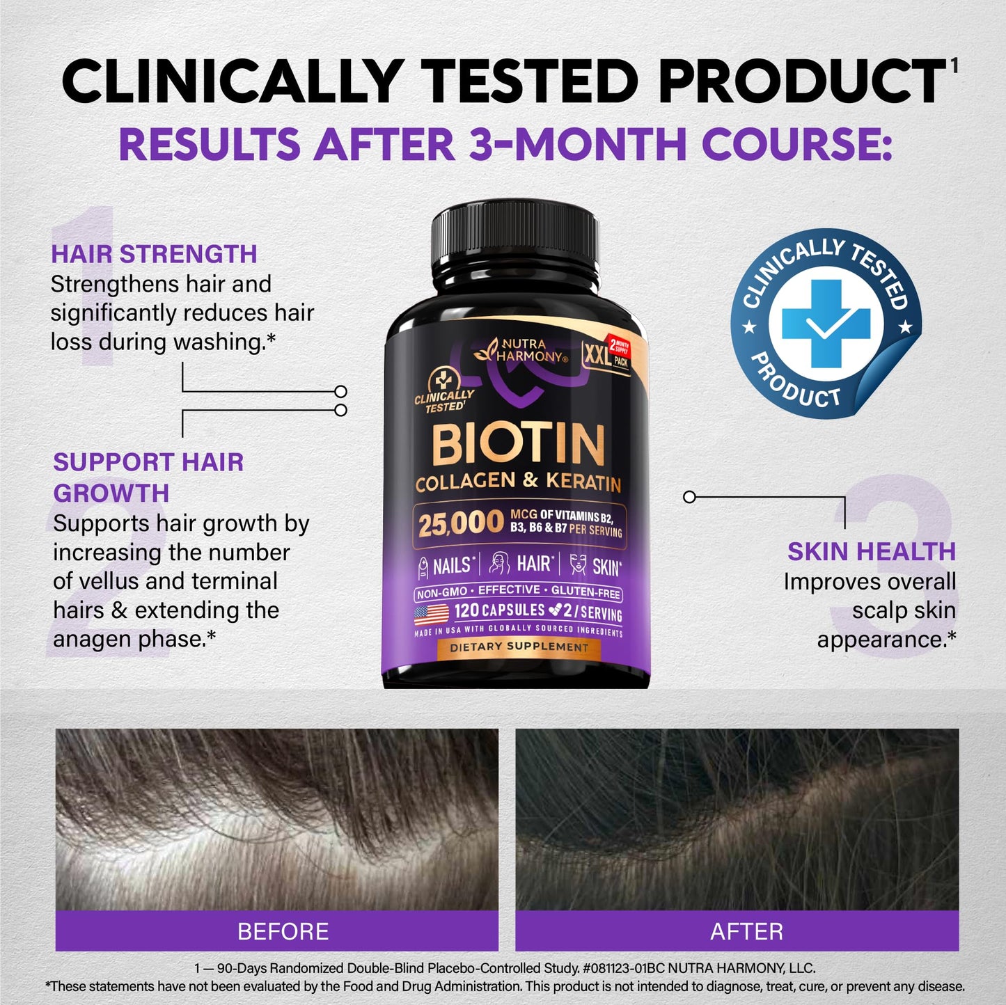 Biotin | Collagen | Hyaluronic Acid | Keratin - Support Normal Hair Growth Cycle, Skin & Nails - Clinically Tested - 25000mcg Vitamins B1, B2, B3, B6 & B7 - for Women & Men - Made in USA, 120 Capsules